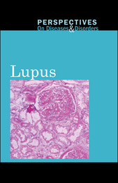 Lupus, ed. , v. 
