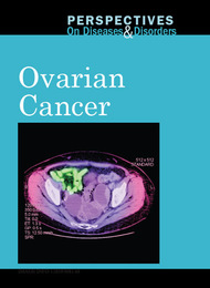 Ovarian Cancer, ed. , v. 
