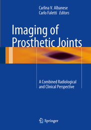 Imaging of Prosthetic Joints, ed. , v. 