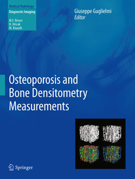 Osteoporosis and Bone Densitometry Measurements, ed. , v. 