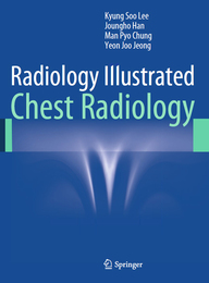 Chest Radiology, ed. , v. 