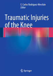 Traumatic Injuries of the Knee, ed. , v. 