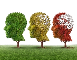 Alzheimer's disease - Degeneration